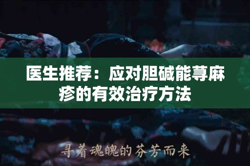 医生推荐：应对胆碱能荨麻疹的有效治疗方法